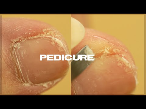 , title : 'Satisfying PEDICURE TRANSFORMATION at home | Cuticle & Callus Removal'
