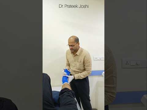 टखने की मोच के कारण 5वें मेटाटार्सल फ्रैक्चर के लिए प्लास्टर #प्लास्टर #टखना #मोच #फाइबरग्लास #ऑर्थो