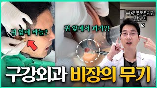 환자들을 위한 구강외과 비장의 무기 l 턱관절 세정술