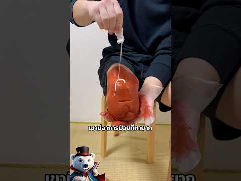 เขาเปลี่ยนความเจ็บปวดให้กลายเป็น แรงบันดาลใจ ที่ยิ่งใหญ่ที่สุด