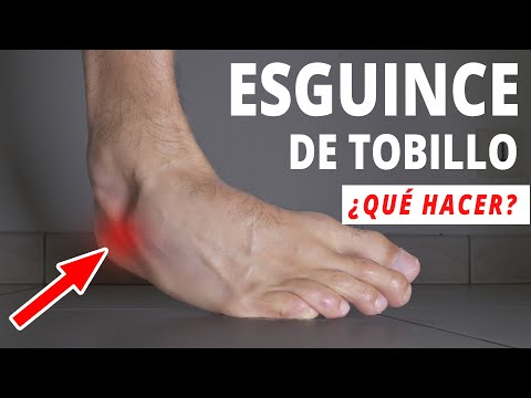 Ankle Sprain: What to Do to Heal Quickly