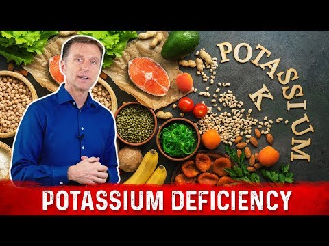 5 Uncommon Signs & Symptoms of Potassium Deficiency – Dr.Berg