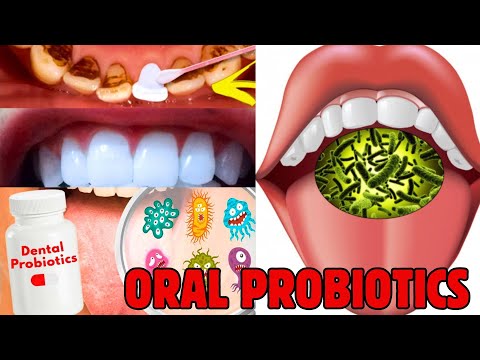 oral probiotic supplement - best dental supplements - best oral probiotics for bad breath; PRODENTIM