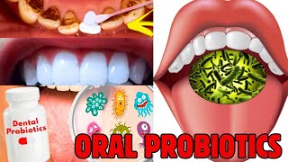 oral probiotic supplement - best dental supplements - best oral probiotics for bad breath; PRODENTIM