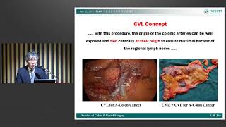 제14회 서울아산병원 외과 연수강좌 : 대장항문외과 미리보기