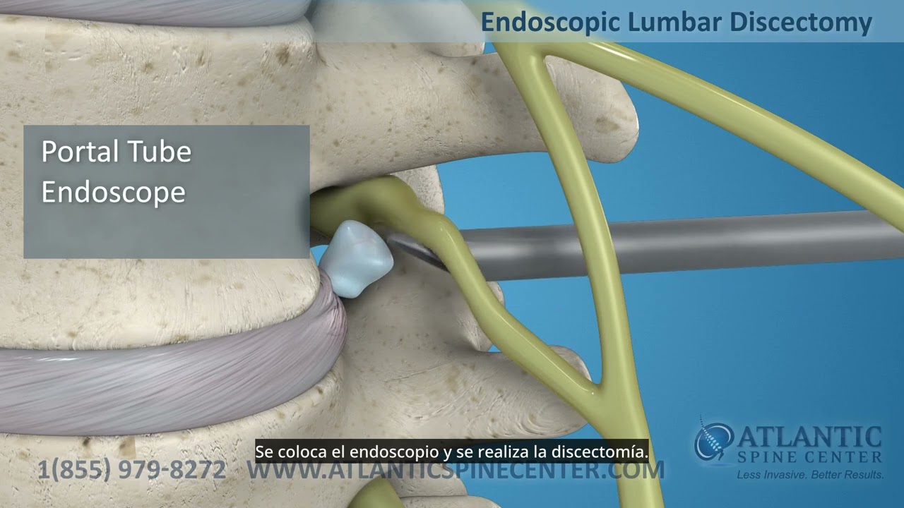 Jorge Alvaro Gonzalez Ross-52