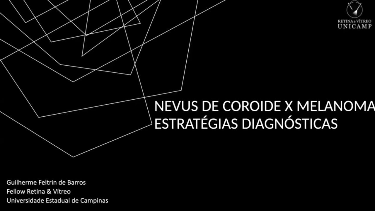 Retina e Vítreo (19/09/2024) - Nevus de Coroide x Melanoma - Estratégias Diagnóstica