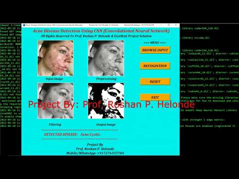 Acne Disease Classification Using Image Processing Python Project With Source Code