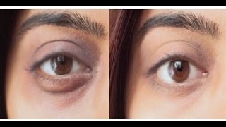 How to Get Rid of Dark Circles _ 7 Days Dark Circle Removal | SuperWowStyle