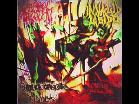 Erythrioblastosis Fetalis - Pathological Postmortem Procedures