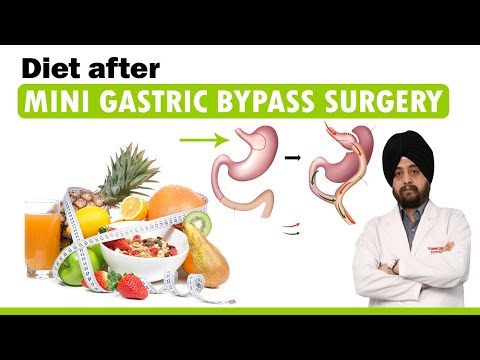 Immediate Post-Surgery Diet Guidelines