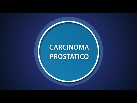 Anatomia umana della vescica e della prostata BPH in funzione per rimuovere gli uomini
