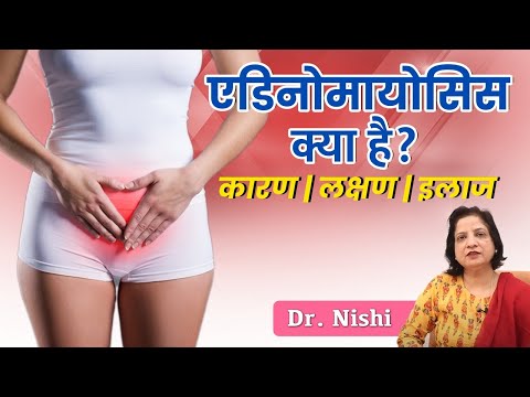 ✅ What is adenomyosis? Adenomyosis Symptoms, Causes And Treatment in Hindi | 💹 Adenomyosis in Hindi