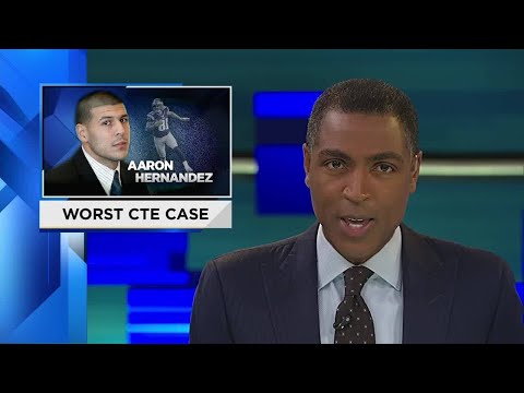 Brain autopsy reveals Aaron Hernandez suffered stage 3 CTE