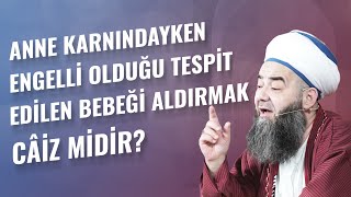 Anne Karnındayken Engelli Olduğu Tespit Edilen Bebeği Aldırmak Câiz midir?