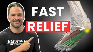 Plantar Fasciitis Isn’t a Foot Problem (Do This Instead)