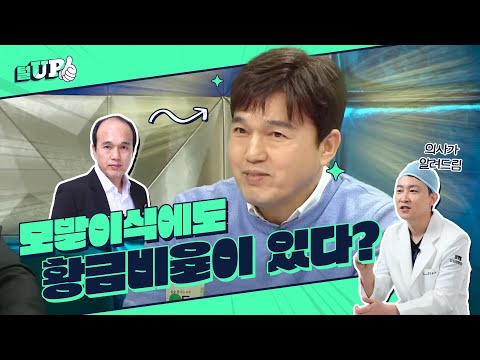 모발이식 디자인! 얼마나 중요한디!ㅣ황금비율 헤어라인ㅣ모모성형외과ㅣ강동우원장