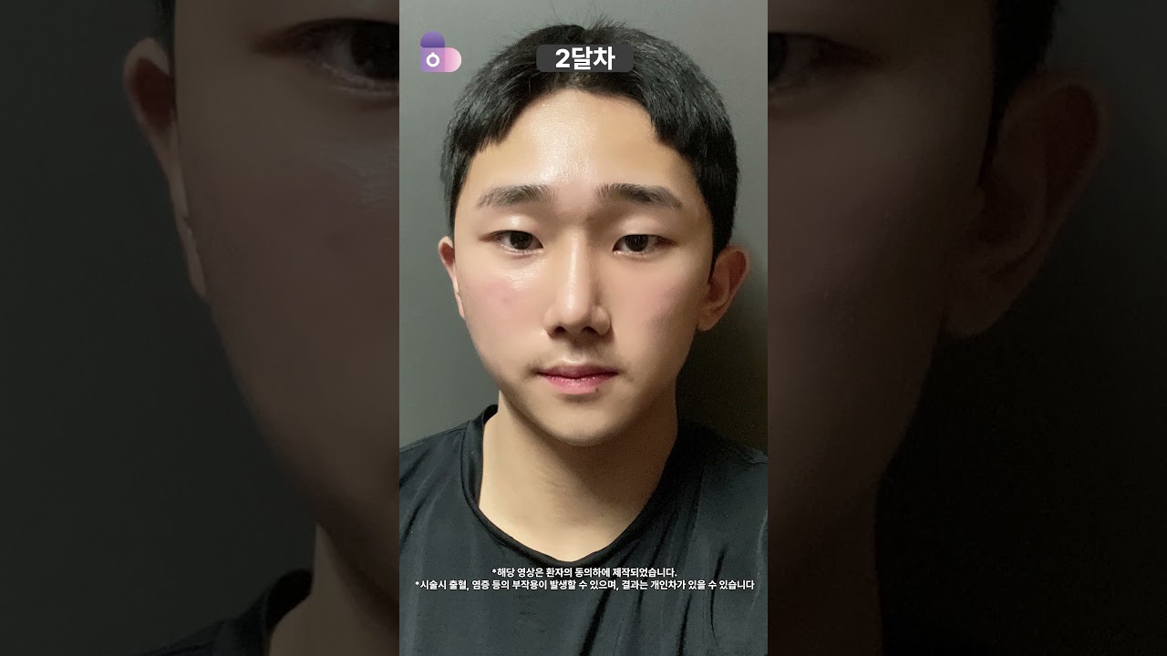 직선이 만드는 남자 '옆 라인'