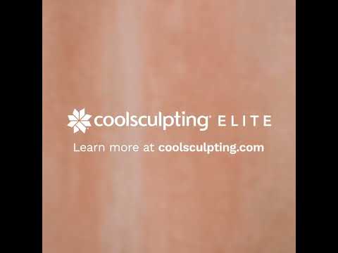 CoolSculpting Videos