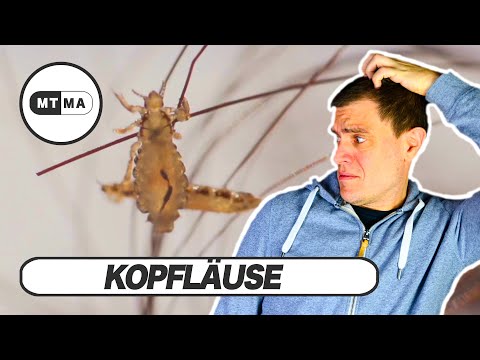 Kopfläuse - Wie bekommt man die? Was machen die? Wie werde ich sie los? Wir klären auf!