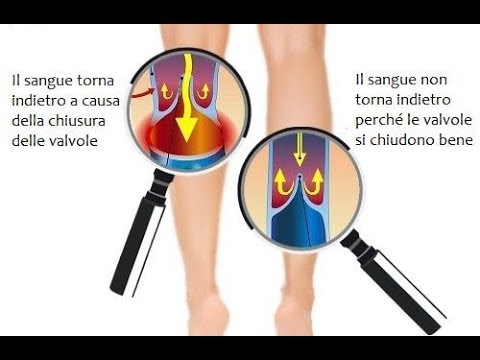 Senza esser finito ha smesso di bere targhe anticoncezionali Colm nello spagnolo