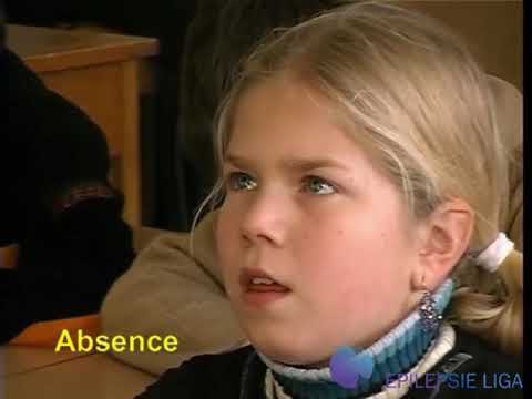 Voorbeeld - Absence epilepsie