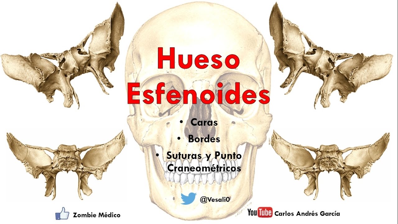 Anatomía - Hueso Esfenoides (Cuerpo, Alas Mayores y Menores, Procesos Pterigoideos)