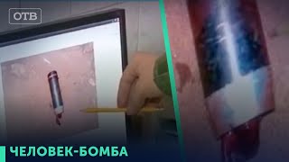 Граната в теле солдата. Шокирующая история