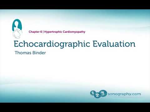 HOCM Hypertrophic Cardiomyopathy Echocardiography Features eg LVOT Obstruction