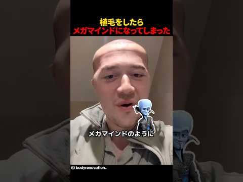 植毛をしたらメガマインドになってしまった