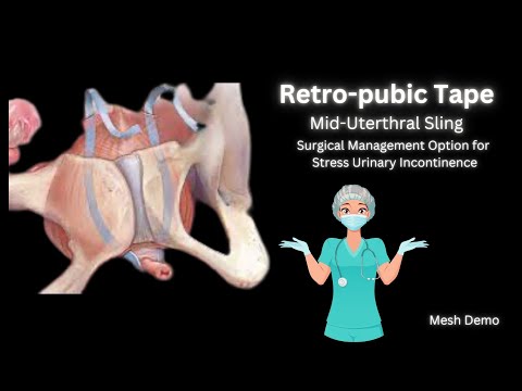Tension Free Vaginal Tape | TVT-R | Retropubic  Tape | The tape we use