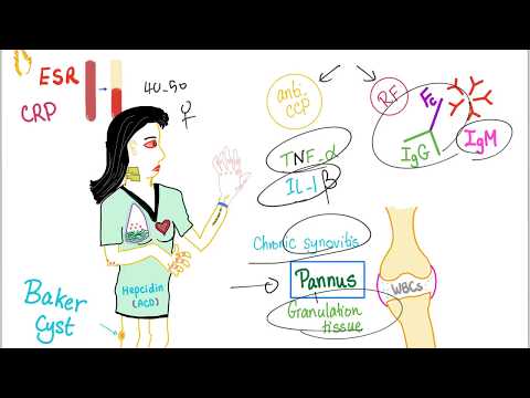 Rheumatoid Arthritis (RA) - Autoimmune Joint Disease - Pathophysiology - Rheumatology Playlist