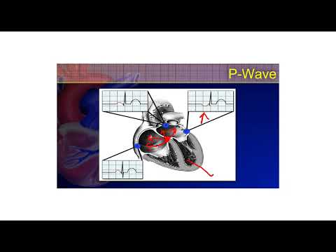 The 12-Lead ECG Course - 2a