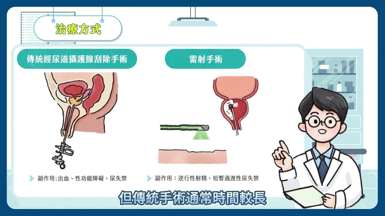 攝護腺水蒸氣消融手術