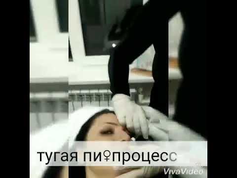 Техника увеличение губ тугая писечка . Емельян Брауде.