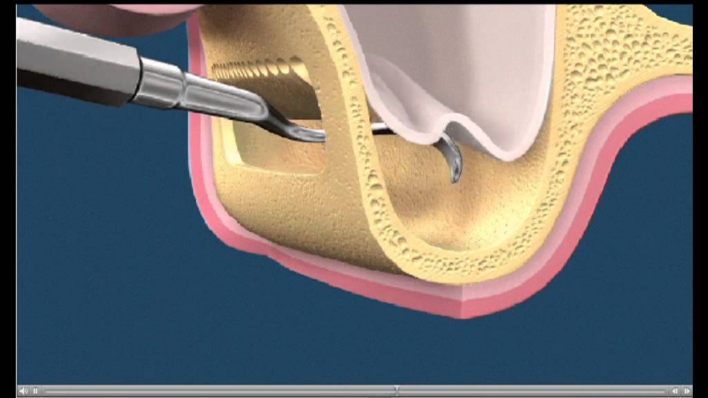 Alessandro Palumbo-60