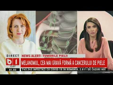EMISIUNEA 360MEDICAL - B1TV - Cancerul de piele, cel mai frecvent neoplasm diagnosticat 07.02.2021