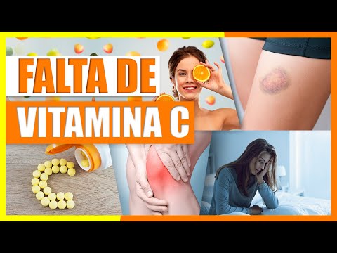 , title : 'Sintomas de Deficiencia de Vitamina C - Tomar Vitamina C Para Evitar Envejecimiento, Aumento de Peso'