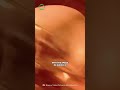 What If You Fall Into The Jupiter S Red Spot Space Universe Astronomy Jupiter