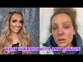 Amy Dowden Strictly Come Dancer Suffers IBD AmyDowdensufferscrohn Sdisease