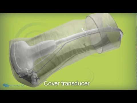 eTRAX™ Needle Guidance System: Revolutionizing Real-Time Ultrasound Navigation