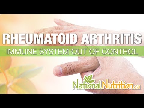 Rheumatoid Arthritis