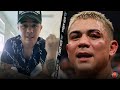 JOSEPH DIAZ JR ON GRUESOME CUT HE SUFFERED IN FARMER FIGHT "IVE NEVER SEEN A CUT THAT F**** BAD"