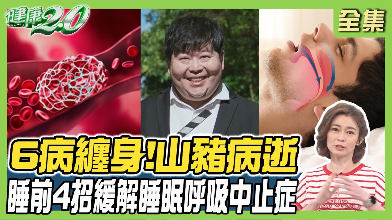 氣功也能治打呼!3動作有效止鼾 中醫師曝2穴位也行