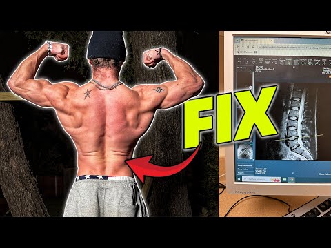 How To CURE Back Pain  | 1000 Weighted Pullups