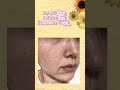 Glow Up Naturally Best Home Remedies For Clear Glowing Skin Get Glass Skin Naturally At Home