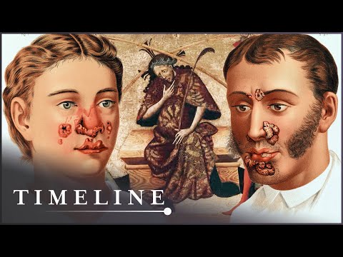 The Syphilis Enigma (Medieval Disease Documentary) | Timeline