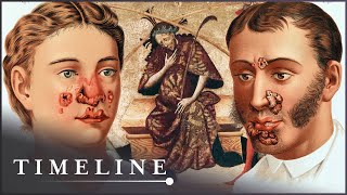 1495 Syphilis Outbreak: The Deadly Disease That Swept Across Europe | The Syphilis Enigma | Timeline