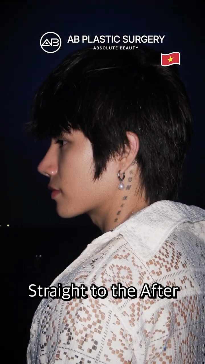 OMG… He Fixed His Jaw & Nose?!