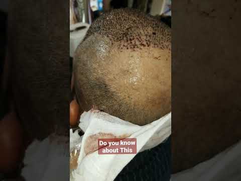 Do yoy Know Why this is Trending on youtube #Shorts